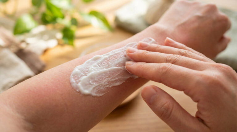 Main appliquant une crème apaisante sur un avant-bras rougi par le soleil. Soulagement de la peau irritée.