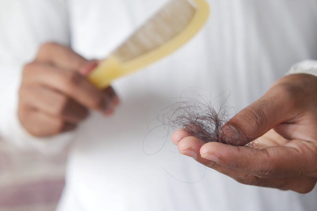 Perte de cheveux : comprendre les causes et les solutions esthétiques actuelles